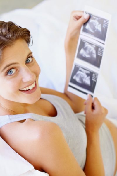 A high-angle view of a pregnant woman looking up at the camera while holding a sonogram picture.